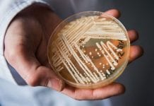 Groźny grzyb, którym się można zarazić w szpitalu