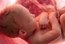 Grupy pro-choice zgarniają rządowe miliony