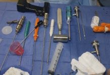 Chirurdzy gubią narzędzia w brzuchach