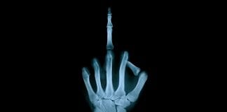 Michalkiewicz: Pokazujemy paluszki