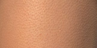 Michalkiewicz: Cierpnie nam skóra