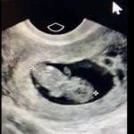 “Mój najmłodszy pacjent został poczęty ” 7 tygodni temu”