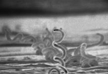 Alberta ma problem z kiłą