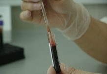 Nowa metoda wykrywania raka made in Canada