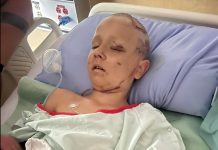 Atak pumy amerykańskiej w okolicy Rocky Mountain House