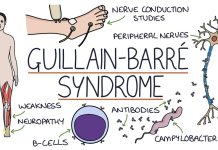 Emeryt z Toronto, u którego zdiagnozowano rzadkie zaburzenie po szczepieniu COVID zeszłego lata, wciąż czeka na odszkodowanie