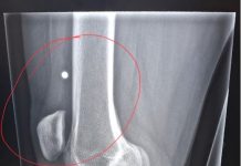 Ukrainka postrzelona z broni śrutowej w ottawskim autobusie