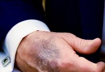 Prezydent Trump – moje zdrowie jest “perfect”